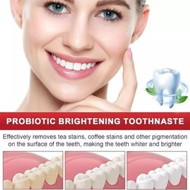 SP 6 Probiotic Whitening Toothpaste - Upgraded Probiotic Formula for Enhanced Oral Health, Whiter Teeth & a Radiant Smile