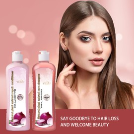 Hair Growth Shampoo and Conditioner Set: Onion Biotin and Rosemary Shampoo and Treatment Set for Thinning Hair and Hair Loss – Strengthens, Nourishes & Promotes Growth Hair and Healthier Scalp