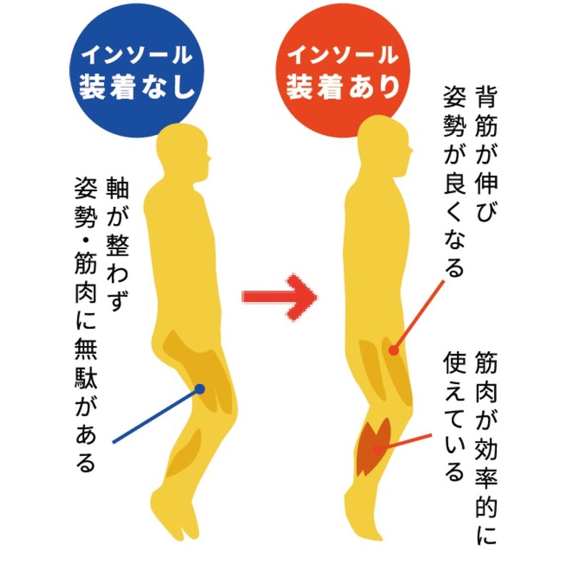 BMZ Training Insole, Asitle, Insole, Walking Training, Posture Support, Standing