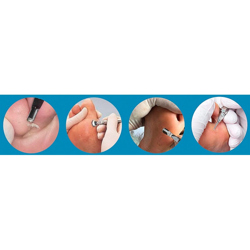 Pack of 10 No. 2 Gouge Blades Foot Care Blades