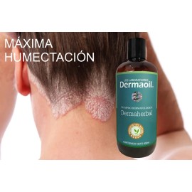 Shampoo Terapéutico Natural Alivio Para Psoriasis Capilar