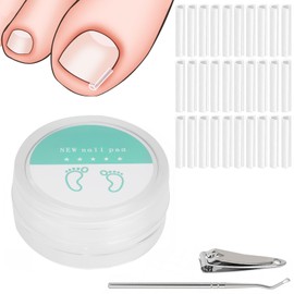 Chisafly Curling Nail Clips, 30 PCS Curling Toenails, 1 Nail Care Tool, 1 Nail Clipper, Recessed Toenails, Special Shape, Just Clip On, Unisex