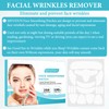 Frownies Anti Wrinkle Patches Wrinkle Patch Face Wrinkle Remover Strips