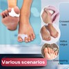 Wonder Care Silikon-Toe Separator für Feet Gel Pads Big Toe