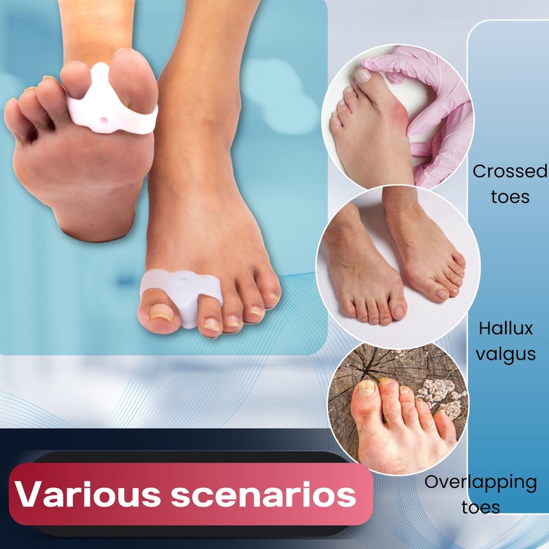Wonder Care Silikon-Toe Separator für Feet Gel Pads Big Toe