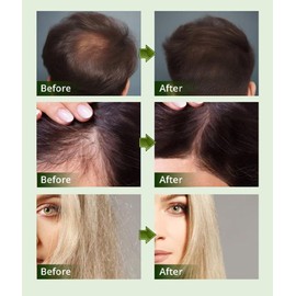 Batana Oil for Hair Growth, Promoting Hair Growth Prevent Hair Loss, for Men & Women. (2Pcs)