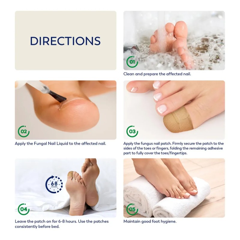 Tratamiento De Hongos En Las Uñas De Los Pies Vigorwell