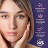 LivaClean 240 Parches para Acne Estrellas Pimple Patch, Parche Hidrocoloide