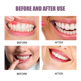 2 * 100G NAT/ure Tooth Refresh Toothpaste with Gum Repair Gel,Enamel Strengthening & Fresh Breath,Removes Stains & Promotes Healthy Teeth,NAT/Ural Oral Care Teeth Repair Gel,Oral Care Whitening Paste