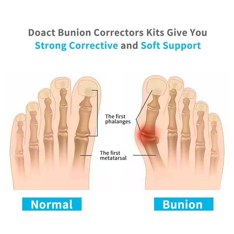 1Pair Bunion Toe Straightener Corrector 3Pair Silicone Gel Toe Separator(L)