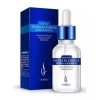 Muye Limpiador Facial Ultrasónico +jabón Arroz +ácido Hialuronico