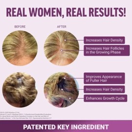 Hair Growth Accelerator Soft 60 Chews, Hair Growth Vitamins for Women New/Sealed