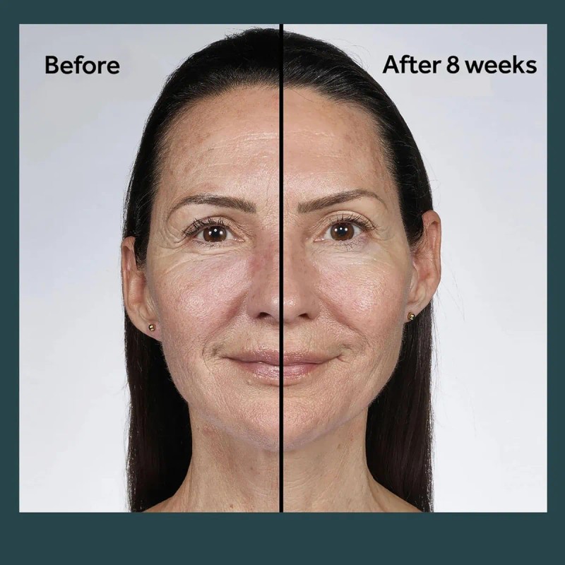 No7 Future Renew Damage Reversal Night Cream - Hidratante Fa