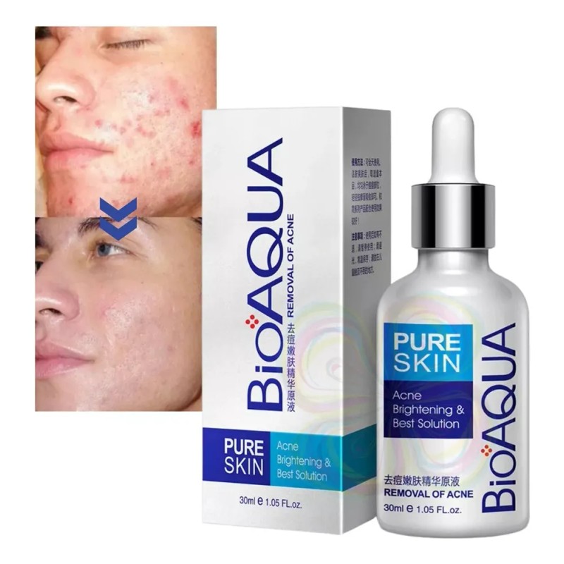 Srum antiacn, reduce granos y espinillas, purifica piel mixta