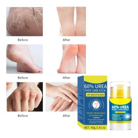 Stick Cuidado Pies 60% Urea 40g Neutra