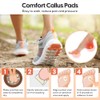 75 almohadillas para callos en dedos y pies, almohadillas de