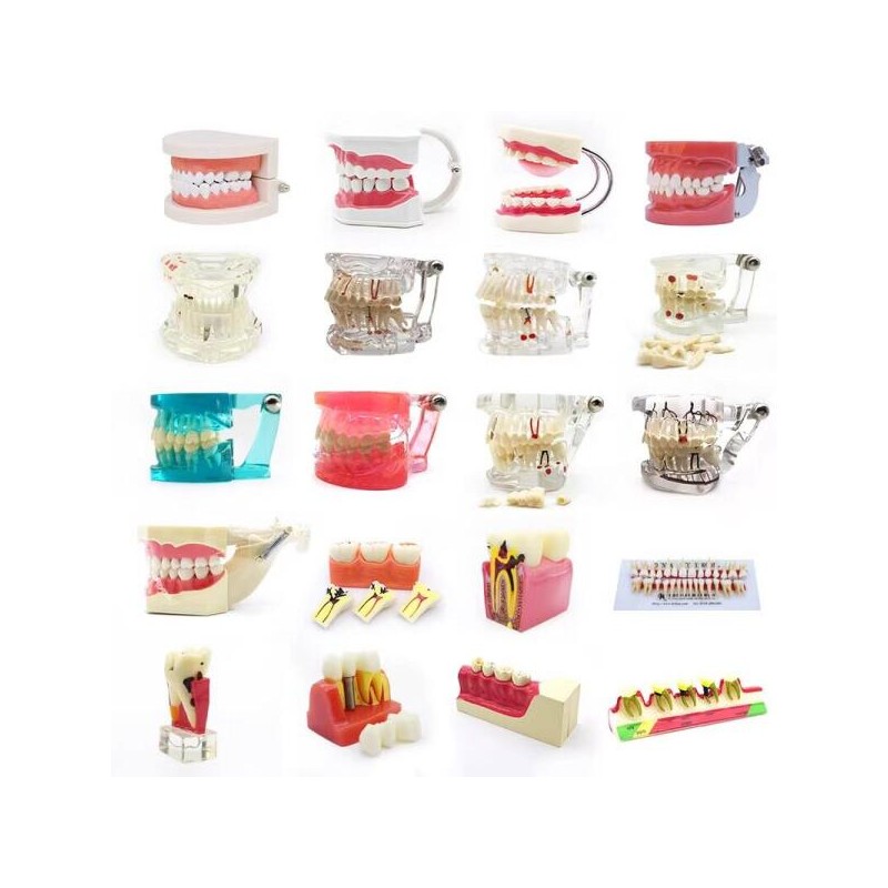 DentiForm 덴티폼 모형 위생사 재료상 모양 임플란트 기공사 입모형 [충치