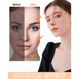 LEAZZLE Pimple Patch Stars 430 Pieces, Pimple Patch, Invisible Hydrocolloid Pimple Tea Tree Oil Day, Breathable Absorption Acne Patches, Night Acne Plasters, Waterproof, Face Anti Acne Skin Treatment