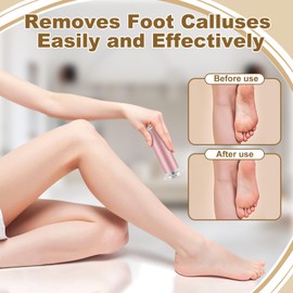Electric Foot Filer Grinder, 2 in 1 Electric Sander Callus Remover with 60Pcs Sandpaper Discs for Feet Heel Shaver, Professional Pedicure Tools for Men Women Dead Cracked Skin and Calluses (Pink US)