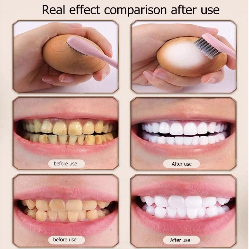 Nicotinamide Teeth Whitening toothpaste Remove Tartar Pemutih gigi kuning pembersih