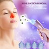 4 Replaceable Heads Blackhead Vacuum Removal Pore Acne Suction Cleanser