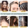 S-noilite Hair Toppers for Thinning Hair Women 130% Density Topper