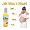 Kit Anti Estrías Y Celulitis + Un Protector De Rozaduras
