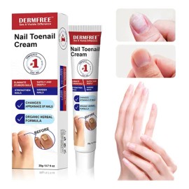 Crema Fúngica Para Uñas,eliminación Hongo De La Uña 20g