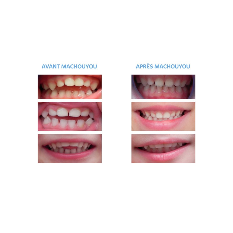 Machouyou Teething Ring