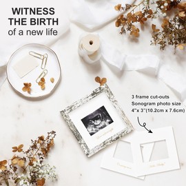 KINLINK Baby Sonogram Picture Frame, Love at First Sight Ultrasound Picture Frame, Pregnancy Gifts for Expecting Mom&Dad, Gender Reveal Party, Baby Keepsake Announcement （Rustic White）