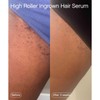 High Roller Ingrown Tonic - Serum for Eliminating Ingrown Hairs