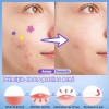 560pzs Mascarillas Estrella Para El Acne Espinillas Granos