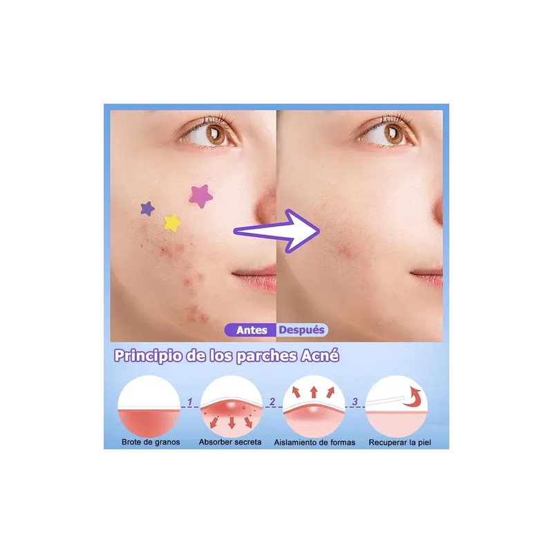 560pzs Mascarillas Estrella Para El Acne Espinillas Granos