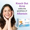 Salve Acnethro Anti Acne Soap with allantoin Vitamin E Aloe