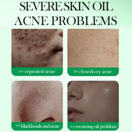 55pcs 3% Salicylic Acid Face Pads - Exfoliating Face Cleansing Pads - Remove Acne,Reduce Blackhead Toner Facial Wipes - Oil Control,Shrink Pores Facial Exfoliating Pad (110g)