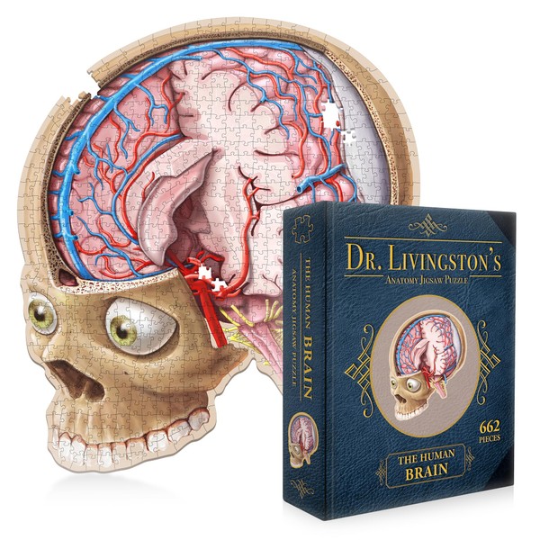 Dr. Livingston's Human Brain Anatomy Puzzle - A Medically Accurate