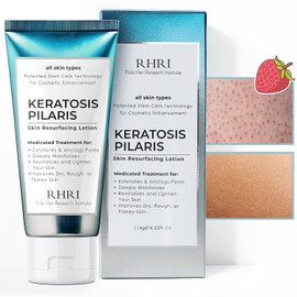 Keratosis Pilaris Treatment | Keratosis Pilaris Lotion | KP Lotion | Gentle Exfoliation For Strawberry Legs, KP & Ingrown Hairs | Smooth & Hydrating Body Lotion For Redness, Dry, Rough And Flaky Skin