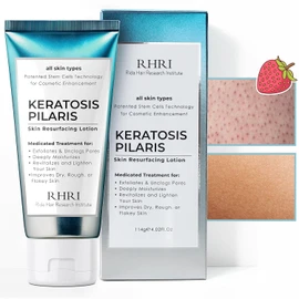 Keratosis Pilaris Treatment | Keratosis Pilaris Lotion | KP Lotion | Gentle Exfoliation For Strawberry Legs, KP & Ingrown Hairs | Smooth & Hydrating Body Lotion For Redness, Dry, Rough And Flaky Skin