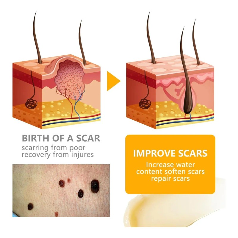 Crema Para El Cuidado De La Piel, Reduce Todo Tipo