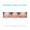 ISDIN Ureadin Podos Gel Oil, Repara e hidrata los pies