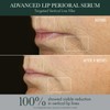 Advanced Lip Perioral Serum / Targeted Vertical Line Filler