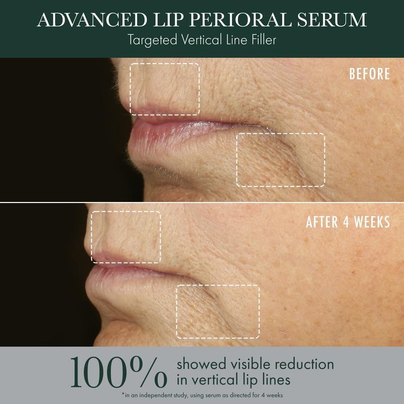 Advanced Lip Perioral Serum / Targeted Vertical Line Filler