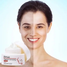 Crema Eelhoe Correctora Pigmentación Elimina Manchas Rostro Día Noche