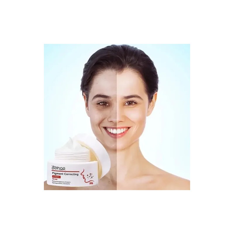 Crema Eelhoe Correctora Pigmentación Elimina Manchas Rostro Día Noche