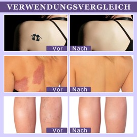 All-Over Teint Perfektionierer, 2PCS All Over Complexion Perfector, Body Coverage Perfector, Bein Make Up Wasserfest ohne Übertragung, Schweißfester Und Lang Anhaltender Concealer (74ml*2)