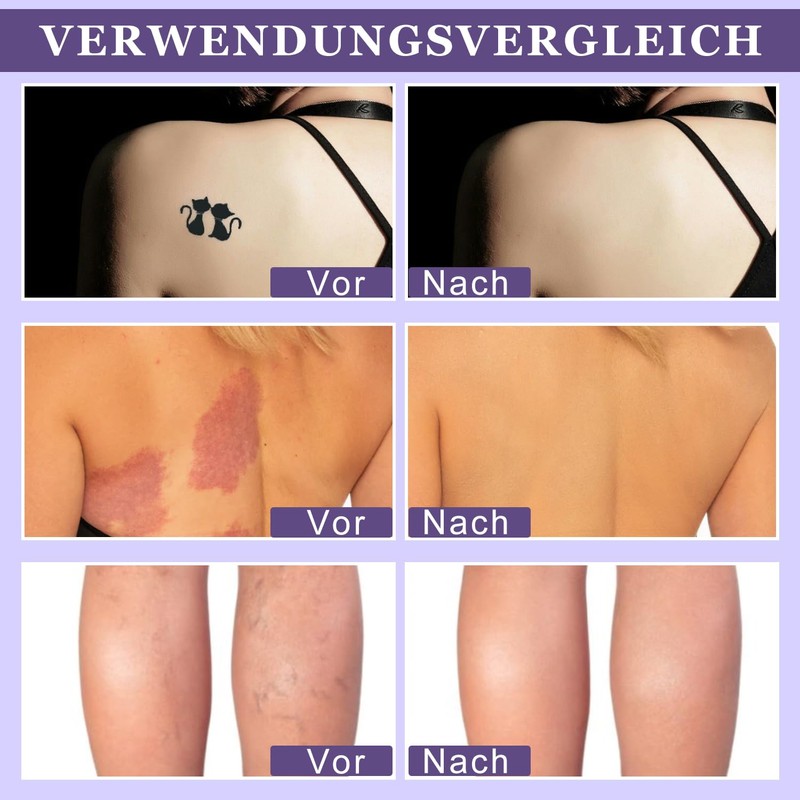 All-Over Teint Perfektionierer, 2PCS All Over Complexion Perfector, Body Coverage