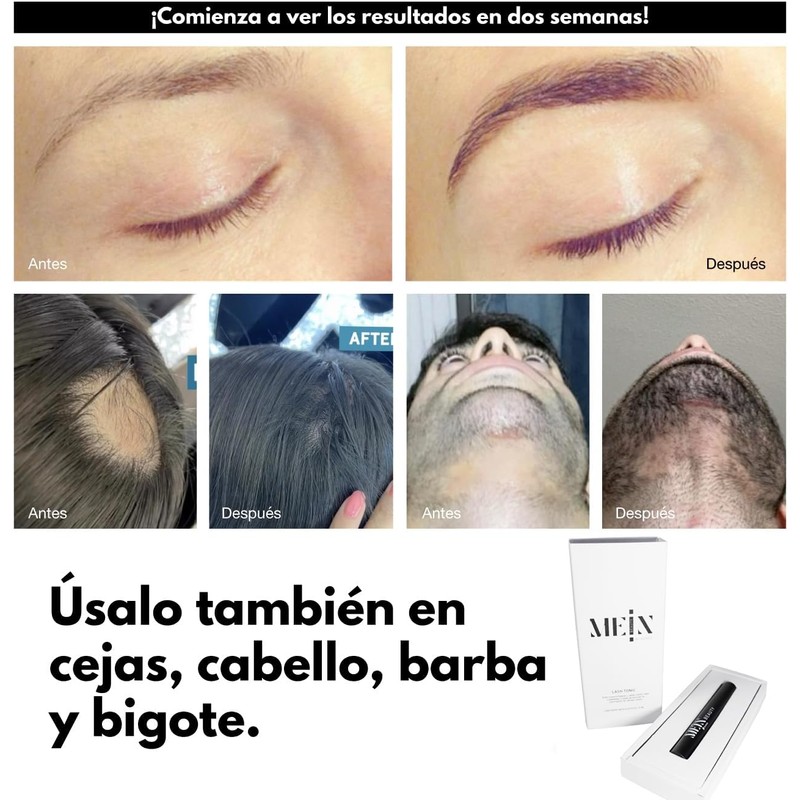 Tonic Mein x MLashes, serum para hacer crecer las pestañas