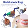 Ceonam 2 Pcs Dental Mirror with Light Tool LED Lighted