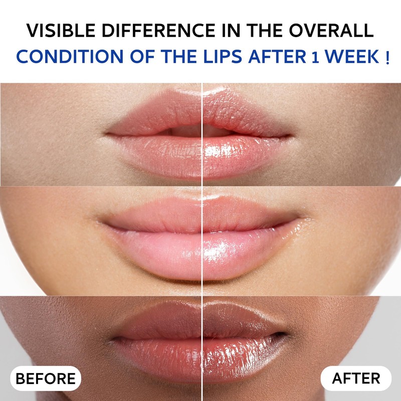 Lip Sleeping Mask (20g), Collagen Lip Mask Overnight, Lip Plumper