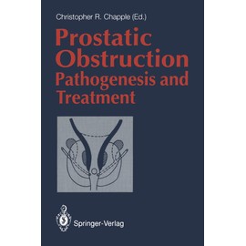 Prostatic Obstruction: Pathogenesis and Treatment